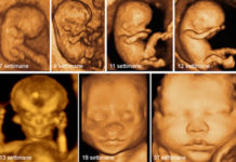 Abortire è uccidere