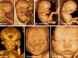 Abortire è uccidere