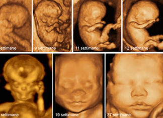 Abortire è uccidere